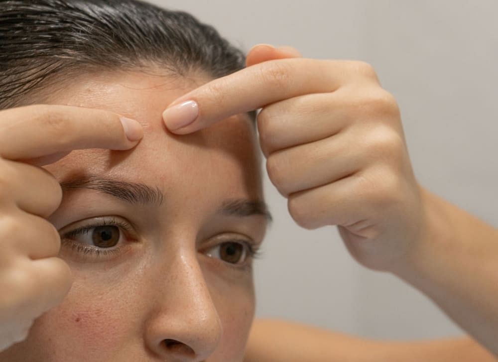 how-to-get-rid-of-a-pimple-or-bump-on-the-eyelid-causes-treatment